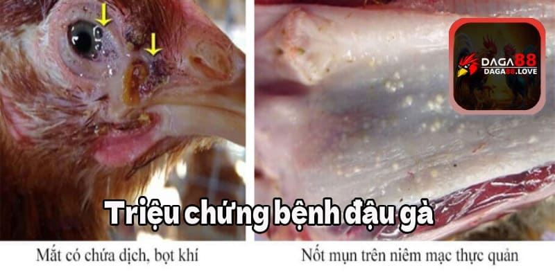 Triệu chứng bệnh đậu gà